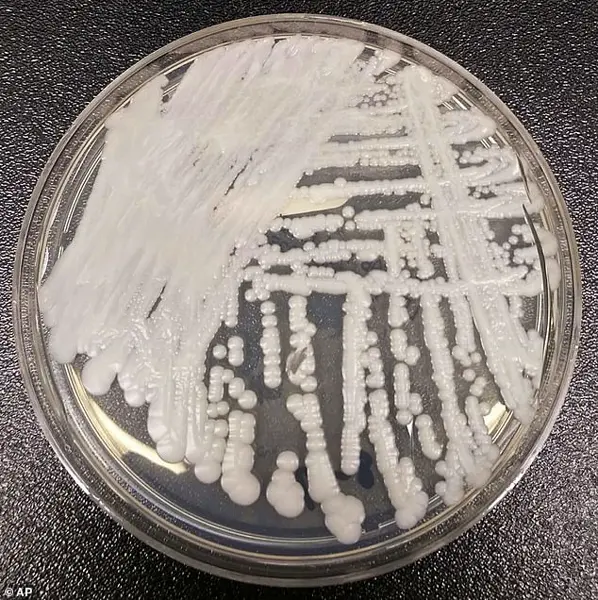 Candida Auris: Deadly, Treatment-Resistant Fungus Spreading in Hospitals, CDC Warns of Growing Threat