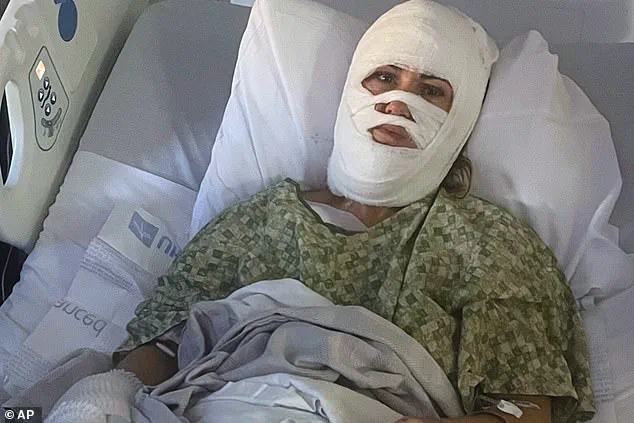 Georgia Woman Victim of Acid Attack Sparks Community Concerns Over Public Safety