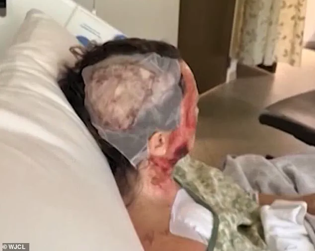 Georgia Woman Victim of Acid Attack Sparks Community Concerns Over Public Safety