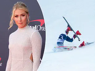 Mikaela Shiffrin's Social Media Post Reveals Back Muscles, Showcasing Alpine Skiing's Physical Demands