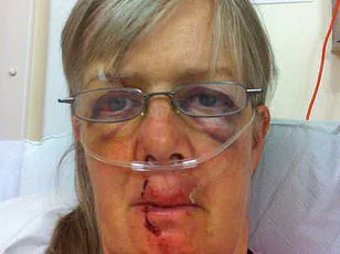 Firefighters Rescue Dog Walker from Tree After Hiding from Angry Cow on Isle of Wight