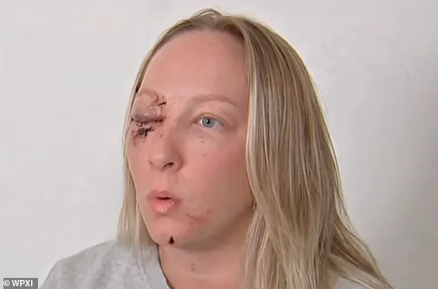 Tragedy on Parkway West: Ice Chunk from Tractor-Trailer Shatters Windshield, Leaves Mother with Severe Injuries as Daughter Witnesses Horror