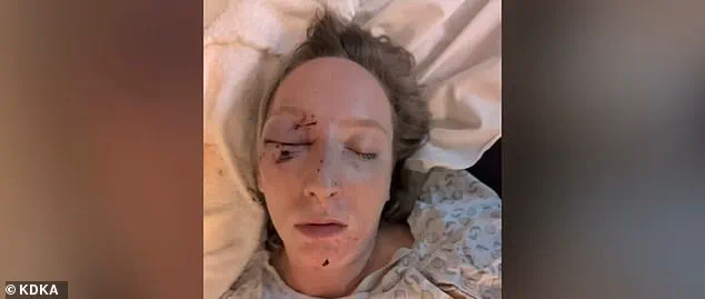 Tragedy on Parkway West: Ice Chunk from Tractor-Trailer Shatters Windshield, Leaves Mother with Severe Injuries as Daughter Witnesses Horror