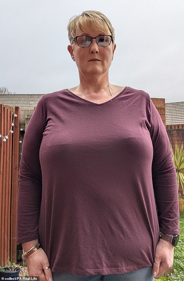 Breast reduction patient denied NHS funding after nerve damage from teasing