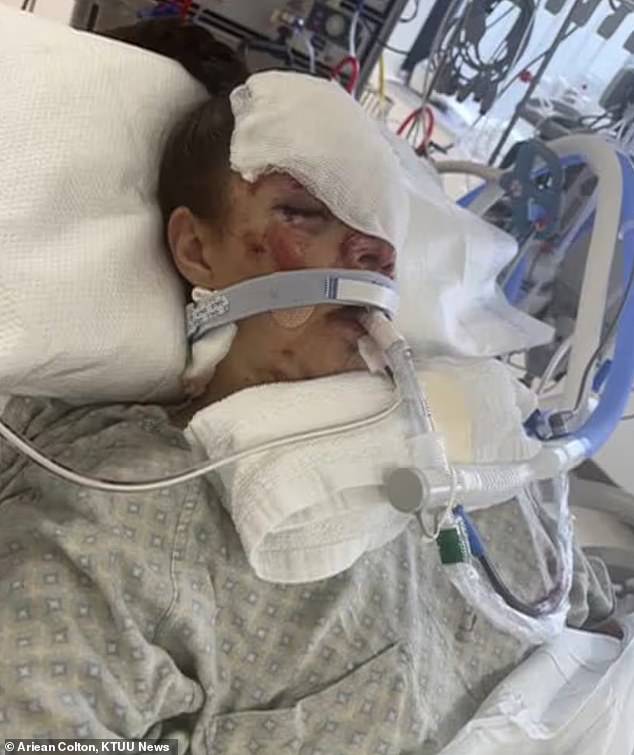 Alaska Mother Reveals Severe Injuries After Being Dragged 100 Yards by Bear