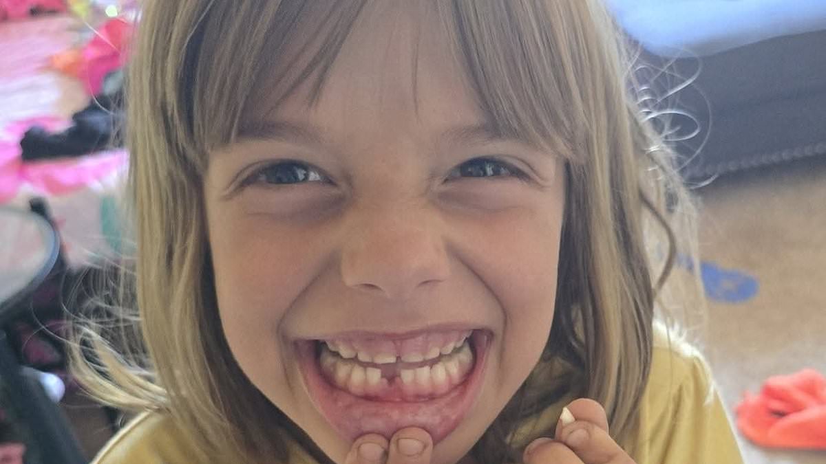 Seven-year-old girl survives vicious ambush by six stray dogs in California.
