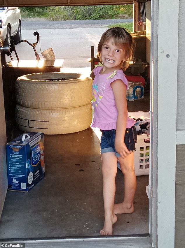 Seven-year-old girl survives vicious ambush by six stray dogs in California.