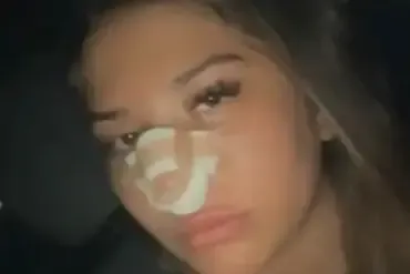 Brazil: Porsche Owner Assails Elderly Man for Noise Complaint