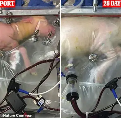 Artificial Wombs: Revolutionizing Pregnancy and Society