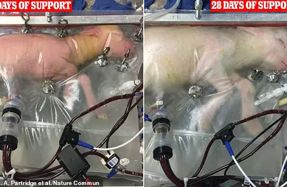 Artificial Wombs: Revolutionizing Pregnancy and Society