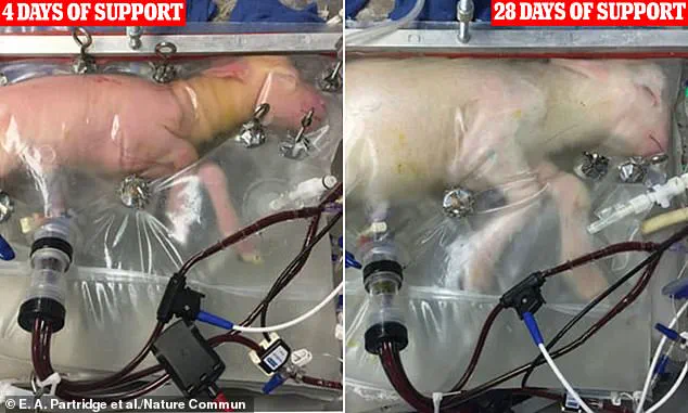 Artificial Wombs: Revolutionizing Pregnancy and Society