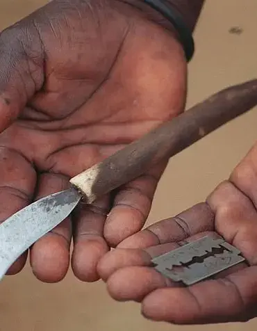 2025 Tribal Initiation Ceremony in South Africa Concludes with 39 Deaths, Sparking Outcry Over Persistent Risks to Teenage Boys